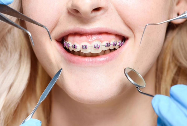 Orthodontic2