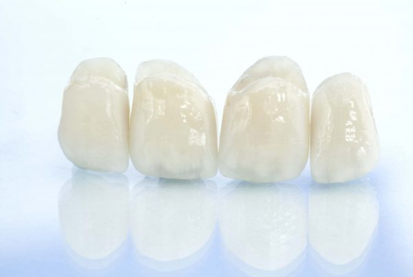 All Ceramic Emax Crowns in Turkey