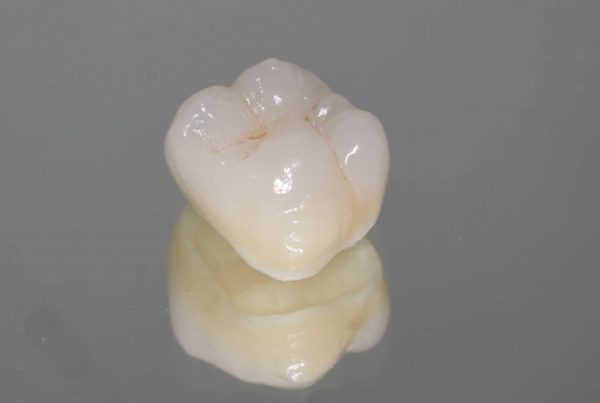 Zirconia Crowns in Turkey